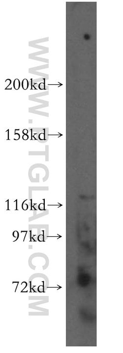 PIGO Rabbit anti-Human, Mouse, Rat, Polyclonal, Proteintech 150 &mu;L;