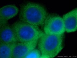 GTPBP9 Rabbit anti-Human, Polyclonal, Proteintech:Antibodies:Primary Antibodies