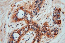 GTPBP9 Rabbit anti-Human, Polyclonal, Proteintech:Antibodies:Primary Antibodies