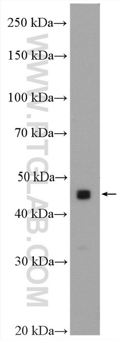 GTPBP9 Rabbit anti-Human, Polyclonal, Proteintech:Antibodies:Primary Antibodies