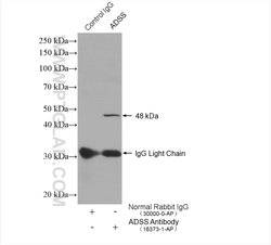 ADSS Rabbit anti-Human, Mouse, Rat, Polyclonal, Proteintech 150 &mu;L;