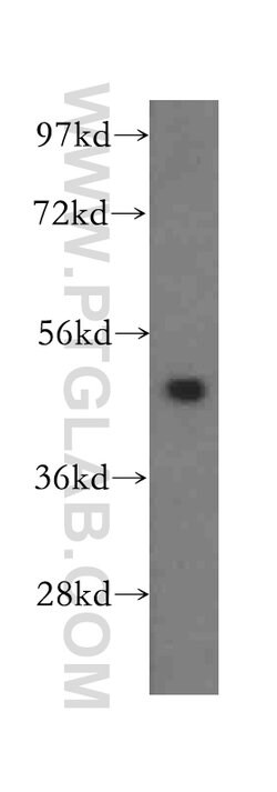 ADSS Rabbit anti-Human, Mouse, Rat, Polyclonal, Proteintech 150 &mu;L;