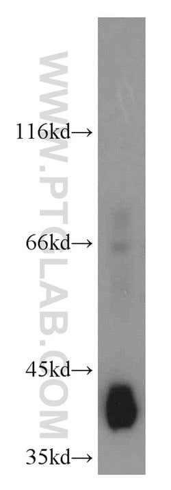 GSNOR/ADH5 Rabbit anti-Human, Mouse, Rat, Polyclonal, Proteintech 150 &mu;L;