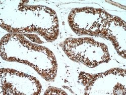 GSNOR/ADH5 Rabbit anti-Human, Mouse, Rat, Polyclonal, Proteintech 150 &mu;L;