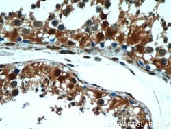 GSNOR/ADH5 Rabbit anti-Human, Mouse, Rat, Polyclonal, Proteintech 150 &mu;L;