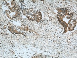 GSNOR/ADH5 Rabbit anti-Human, Mouse, Rat, Polyclonal, Proteintech 150 &mu;L;