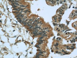 GSNOR/ADH5 Rabbit anti-Human, Mouse, Rat, Polyclonal, Proteintech 150 &mu;L;