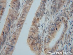 GSNOR/ADH5 Rabbit anti-Human, Mouse, Rat, Polyclonal, Proteintech 150 &mu;L;