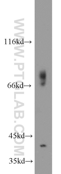 GSNOR/ADH5 Rabbit anti-Human, Mouse, Rat, Polyclonal, Proteintech 150 &mu;L;