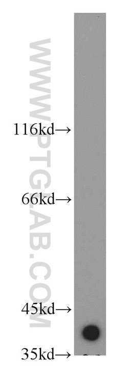 GSNOR/ADH5 Rabbit anti-Human, Mouse, Rat, Polyclonal, Proteintech 150 &mu;L;