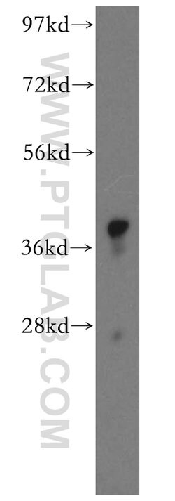 GSNOR/ADH5 Rabbit anti-Human, Mouse, Rat, Polyclonal, Proteintech 150 &mu;L;