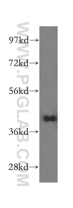 GSNOR/ADH5 Rabbit anti-Human, Mouse, Rat, Polyclonal, Proteintech 150 &mu;L;