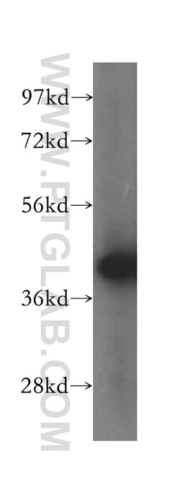 GSNOR/ADH5 Rabbit anti-Human, Mouse, Rat, Polyclonal, Proteintech 150 &mu;L;