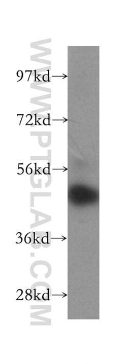 CSNK1G1 Rabbit anti-Human, Mouse, Non-human primate, Rat, Polyclonal, Proteintech:Antibodies:Primary
