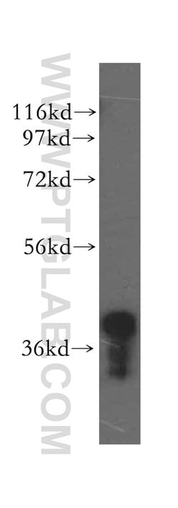 MRPL44 Rabbit anti-Human, Mouse, Rat, Polyclonal, Proteintech 150 &mu;L;