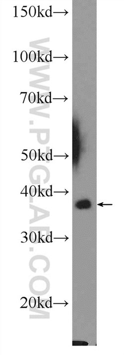 MRPL44 Rabbit anti-Human, Mouse, Rat, Polyclonal, Proteintech 150 &mu;L;