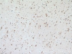 CERCAM Rabbit anti-Human, Mouse, Rat, Polyclonal, Proteintech 150 &mu;L;