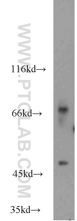CERCAM Rabbit anti-Human, Mouse, Rat, Polyclonal, Proteintech 150 &mu;L;