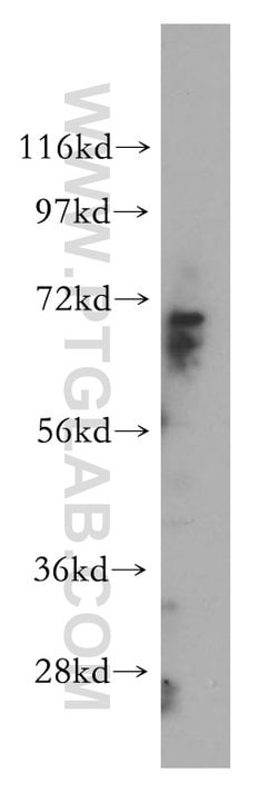 CERCAM Rabbit anti-Human, Mouse, Rat, Polyclonal, Proteintech 150 &mu;L;