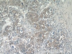 SMCR7/MID49 Rabbit anti-Human, Mouse, Polyclonal, Proteintech:Antibodies:Primary