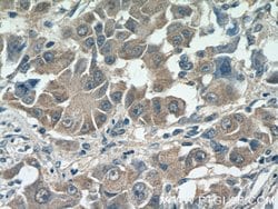 SMCR7/MID49 Rabbit anti-Human, Mouse, Polyclonal, Proteintech:Antibodies:Primary