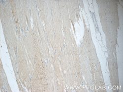 SMCR7/MID49 Rabbit anti-Human, Mouse, Polyclonal, Proteintech:Antibodies:Primary