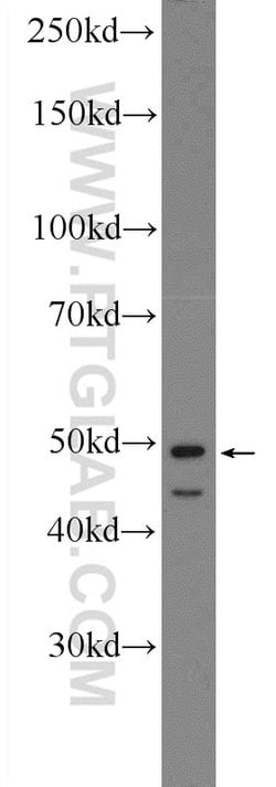 SMCR7/MID49 Rabbit anti-Human, Mouse, Polyclonal, Proteintech:Antibodies:Primary