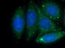 Antithrombin III Rabbit anti-Human, Polyclonal, Proteintech 150 &mu;L;