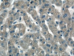 Antithrombin III Rabbit anti-Human, Polyclonal, Proteintech 150 &mu;L;