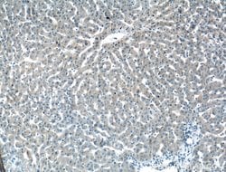 Antithrombin III Rabbit anti-Human, Polyclonal, Proteintech 150 &mu;L;