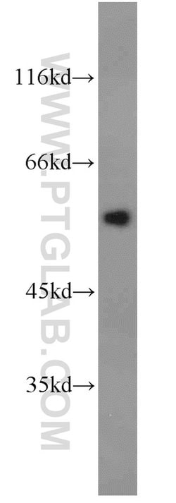 Antithrombin III Rabbit anti-Human, Polyclonal, Proteintech 150 &mu;L;
