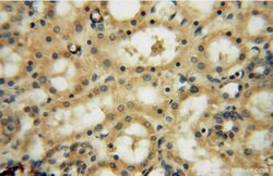 FUCA1 Rabbit anti-Human, Mouse, Rat, Polyclonal, Proteintech 150 &mu;L;