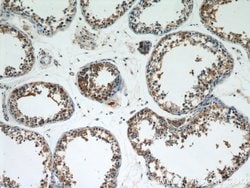 FUCA1 Rabbit anti-Human, Mouse, Rat, Polyclonal, Proteintech 150 &mu;L;