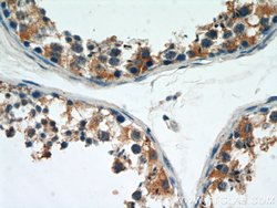 FUCA1 Rabbit anti-Human, Mouse, Rat, Polyclonal, Proteintech 150 &mu;L;