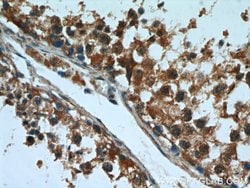 FUCA1 Rabbit anti-Human, Mouse, Rat, Polyclonal, Proteintech 150 &mu;L;