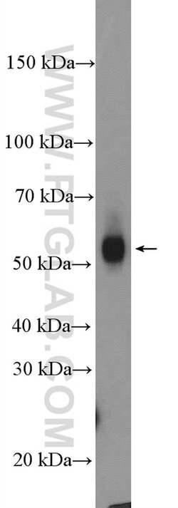 FUCA1 Rabbit anti-Human, Mouse, Rat, Polyclonal, Proteintech 150 &mu;L;