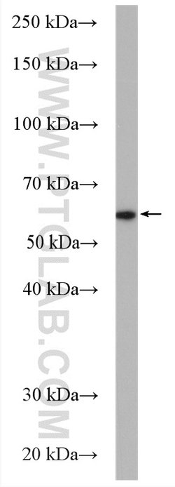 FUCA1 Rabbit anti-Human, Mouse, Rat, Polyclonal, Proteintech 150 &mu;L;