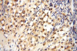 DLD Rabbit anti-Human, Mouse, Rat, Polyclonal, Proteintech 20 &mu;L; Unconjugated:Anticuerpos