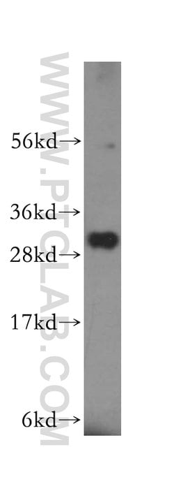 NIT2 Rabbit anti-Human, Mouse, Rat, Polyclonal, Proteintech 150 &mu;L;
