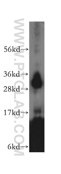 NIT2 Rabbit anti-Human, Mouse, Rat, Polyclonal, Proteintech 150 &mu;L;