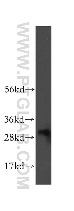 NIT2 Rabbit anti-Human, Mouse, Rat, Polyclonal, Proteintech 150 &mu;L;
