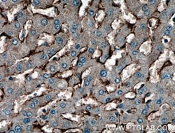 Caveolin-1 Rabbit anti-Human, Mouse, Rat, Polyclonal, Proteintech:Antibodies:Primary
