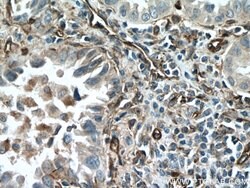 Caveolin-1 Rabbit anti-Human, Mouse, Rat, Polyclonal, Proteintech:Antibodies:Primary