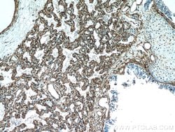 Caveolin-1 Rabbit anti-Human, Mouse, Rat, Polyclonal, Proteintech:Antibodies:Primary