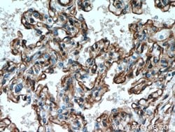 Caveolin-1 Rabbit anti-Human, Mouse, Rat, Polyclonal, Proteintech:Antibodies:Primary