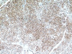 Caveolin-1 Rabbit anti-Human, Mouse, Rat, Polyclonal, Proteintech:Antibodies:Primary