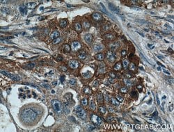 Caveolin-1 Rabbit anti-Human, Mouse, Rat, Polyclonal, Proteintech:Antibodies:Primary