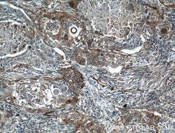 Caveolin-1 Rabbit anti-Human, Mouse, Rat, Polyclonal, Proteintech:Antibodies:Primary