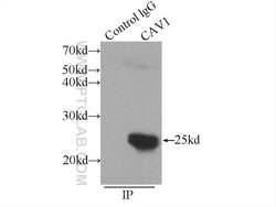 Caveolin-1 Rabbit anti-Human, Mouse, Rat, Polyclonal, Proteintech:Antibodies:Primary