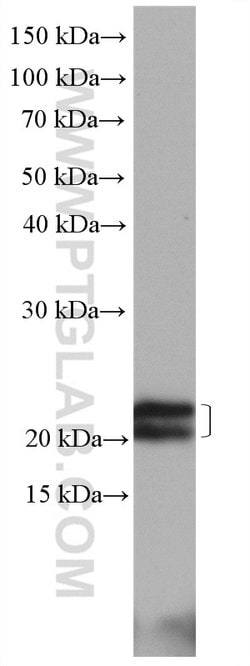 Caveolin-1 Rabbit anti-Human, Mouse, Rat, Polyclonal, Proteintech:Antibodies:Primary